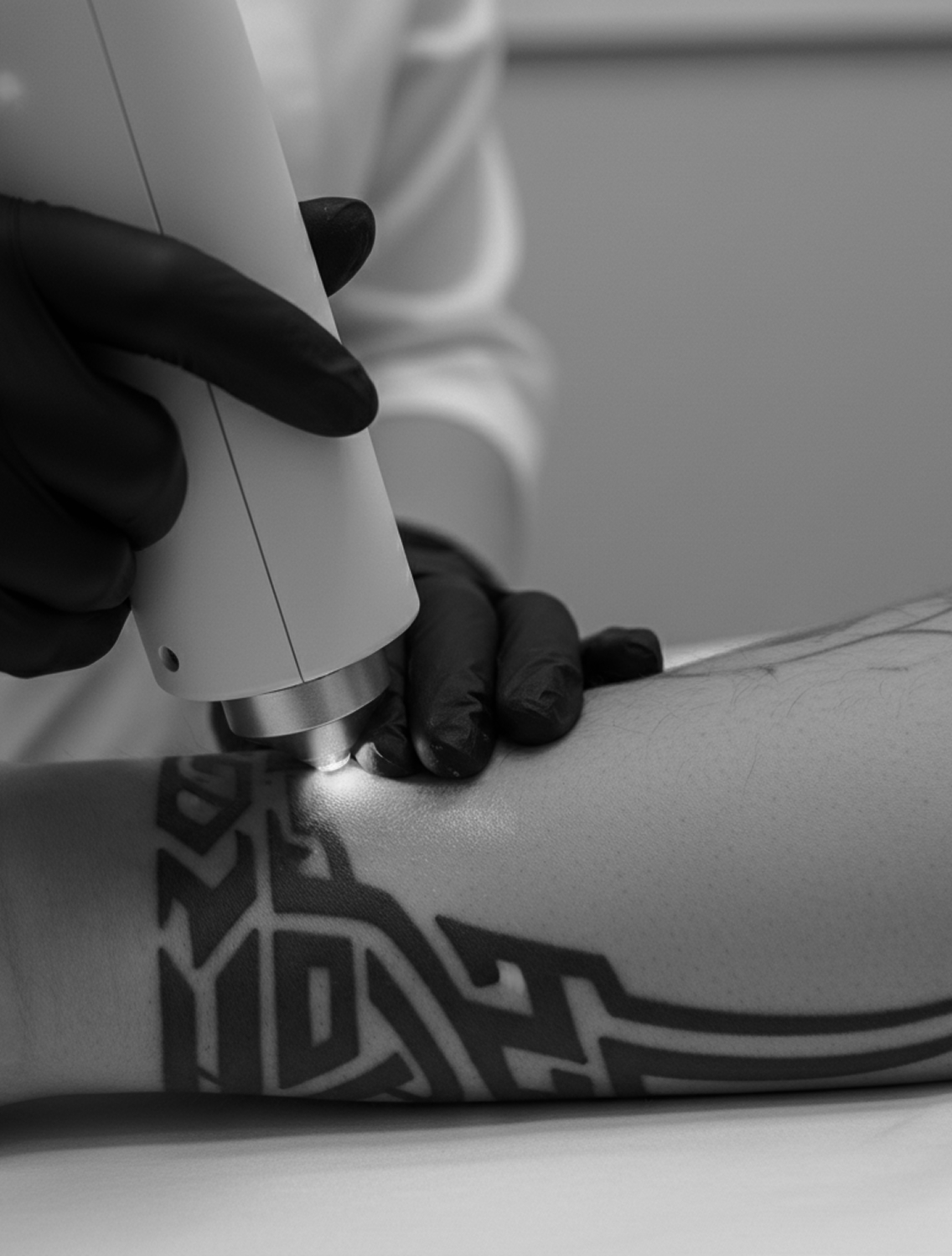 BLVCK ART TATTOO Detatouage Technologie
